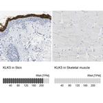 Kallikrein 5 Antibody