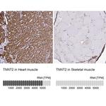 Cardiac Troponin T Antibody