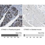 delta Catenin Antibody