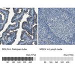 Mesothelin Antibody