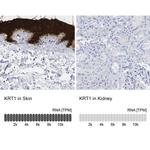 Cytokeratin 1 Antibody