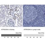 ATP6V0A4 Antibody