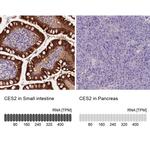 CES2 Antibody