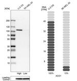 Aconitase 1 Antibody