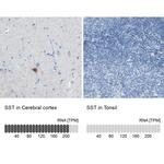 Somatostatin Antibody