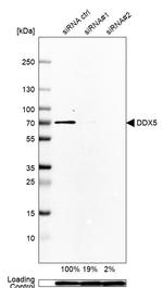 DDX5 Antibody