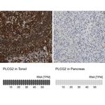 PLCG2 Antibody