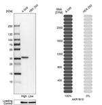 AKR1B10 Antibody