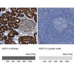 ASS1 Antibody