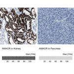 AMACR Antibody