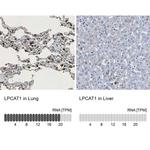 LPCAT1 Antibody