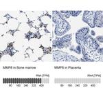 MMP8 Antibody