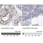 CALCOCO2 Antibody