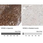 NFkB p52 Antibody