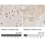 p40 Antibody