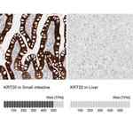 Cytokeratin 20 Antibody