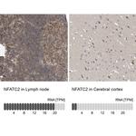 NFATC2 Antibody