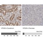 VPS28 Antibody