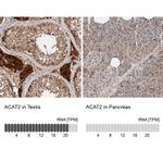 ACAT2 Antibody