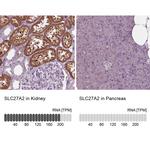 SLC27A2 Antibody