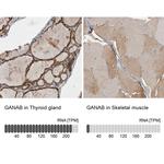 GANAB Antibody