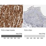 Phospholamban Antibody