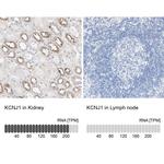 Kir1.1 (KCNJ1) Antibody