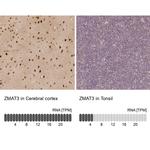 ZMAT3 Antibody