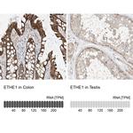 ETHE1 Antibody