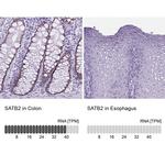 SATB2 Antibody