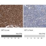 GPT Antibody