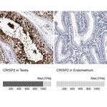 CRISP2 Antibody