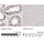 ZMYM2 Antibody