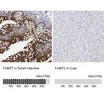 FABP2 Antibody