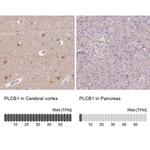 PLCB1 Antibody