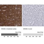 beta Synuclein Antibody