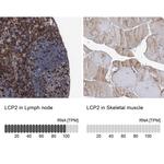 SLP76 Antibody