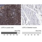 SLP76 Antibody