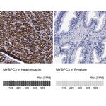 MYBPC3 Antibody