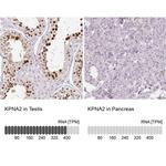 KPNA2 Antibody