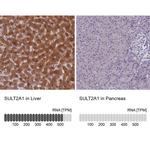 SULT2A1 Antibody