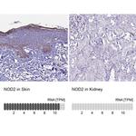 NOD2 Antibody