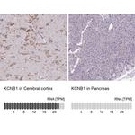 KV2.1 (KCNB1) Antibody