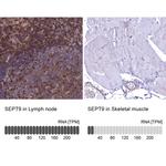 Septin-9 Antibody