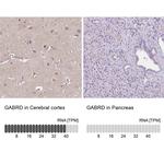 GABRD Antibody