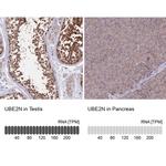 UBC13 Antibody