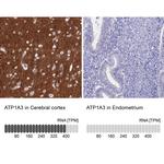 ATP1A3 Antibody