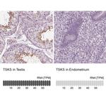 TSKS Antibody