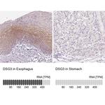 Desmoglein 3 Antibody