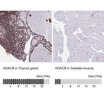 HDAC8 Antibody